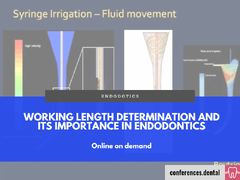 Working length determination and its importance in endodontics (Online on demand)