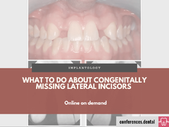 What to Do About Congenitally Missing Lateral Incisors (Online on demand)