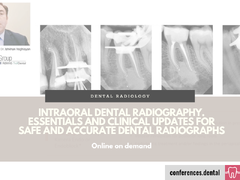 Essentials and clinical updates for safe and accurate dental radiographs (Online on demand)