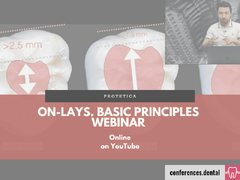 ONLAYS. Basic Principles (Online on demand)